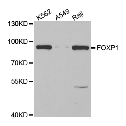 Anti-FOXP1 Antibody from Bioworld Technology (BS7522) - Antibodies.com