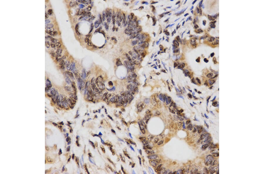 Anti-Histone H3 (Di-Methyl K14) Antibody from Bioworld Technology (BS7524) - Antibodies.com