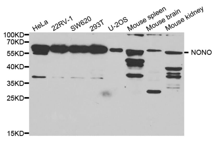 Anti-NONO Antibody from Bioworld Technology (BS7526) - Antibodies.com