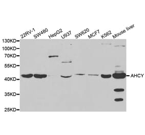 Anti-AHCY Antibody from Bioworld Technology (BS7528) - Antibodies.com