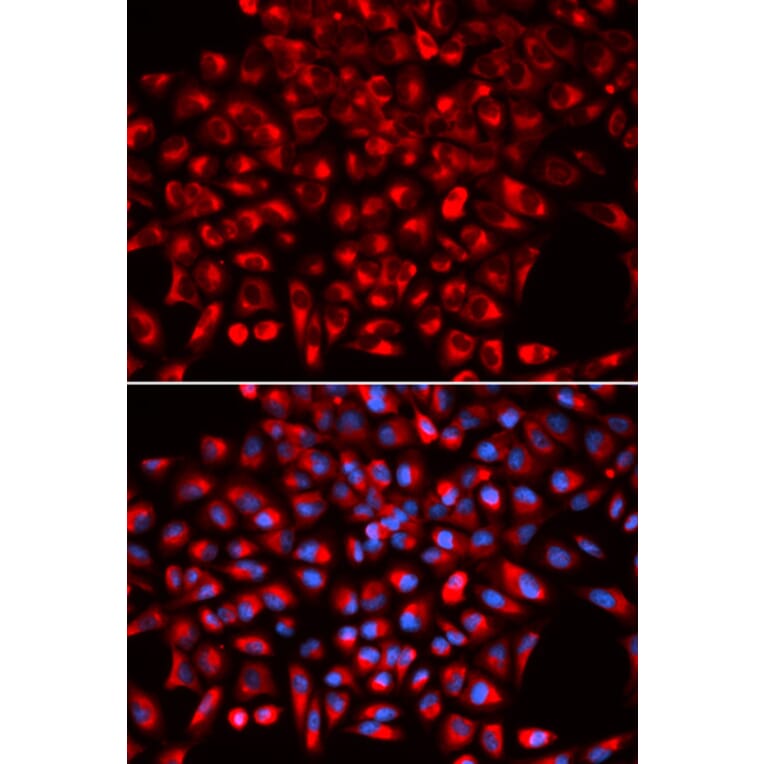 Anti-AIMP1 Antibody from Bioworld Technology (BS7529) - Antibodies.com