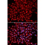 Anti-AIMP1 Antibody from Bioworld Technology (BS7529) - Antibodies.com