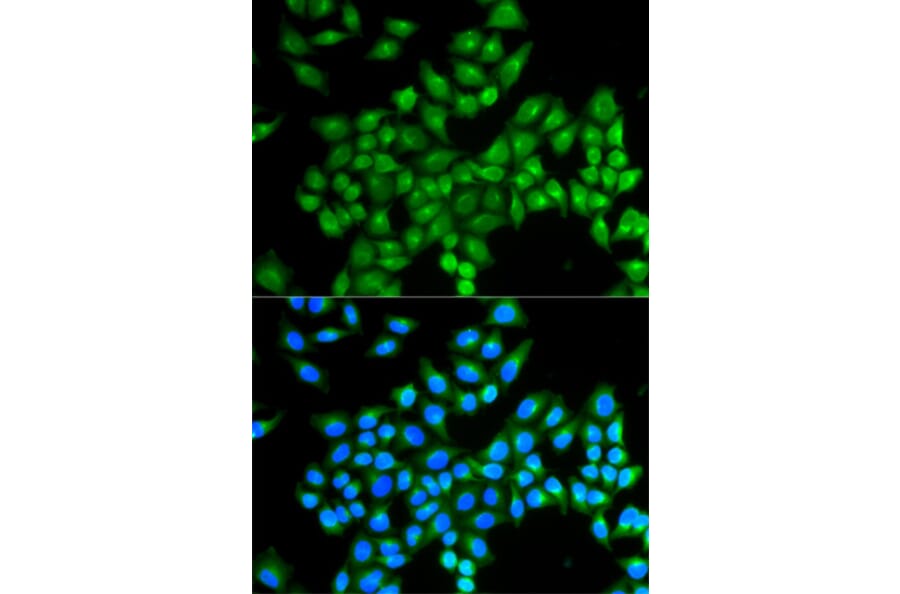 Anti-DAO Antibody from Bioworld Technology (BS7532) - Antibodies.com