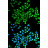 Anti-DAO Antibody from Bioworld Technology (BS7532) - Antibodies.com