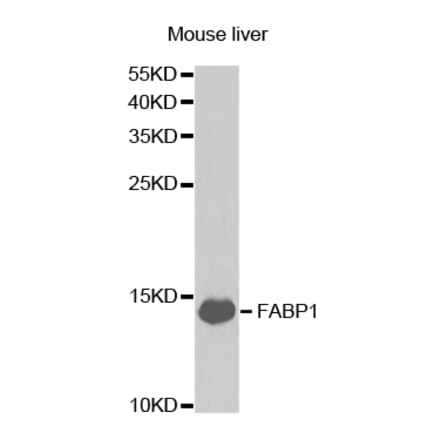 Anti-FABP1 Antibody from Bioworld Technology (BS7533) - Antibodies.com