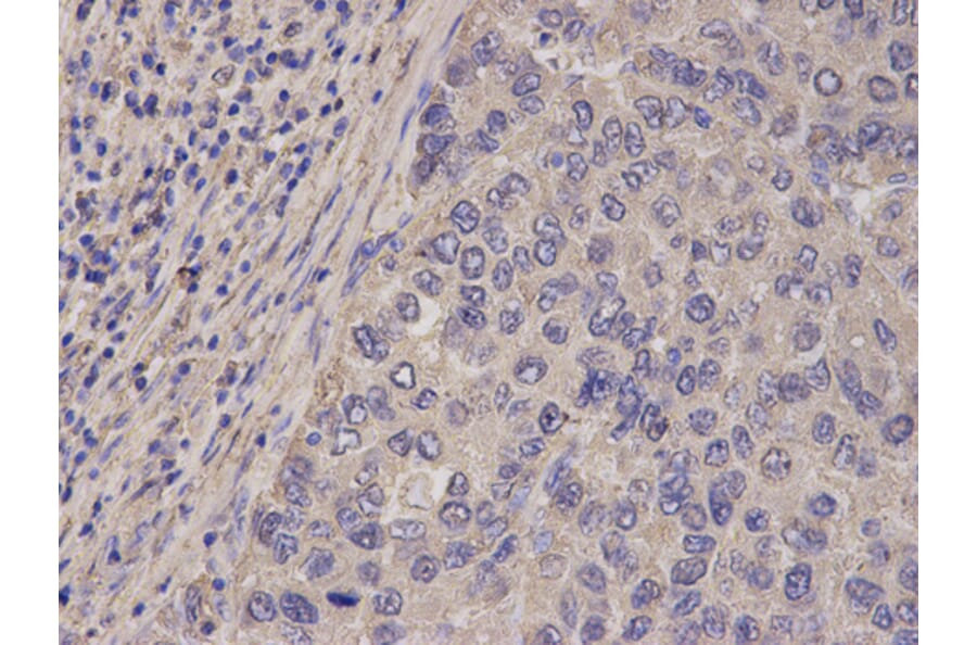 Anti-FABP1 Antibody from Bioworld Technology (BS7533) - Antibodies.com