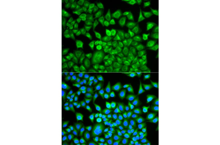 Anti-FABP1 Antibody from Bioworld Technology (BS7533) - Antibodies.com