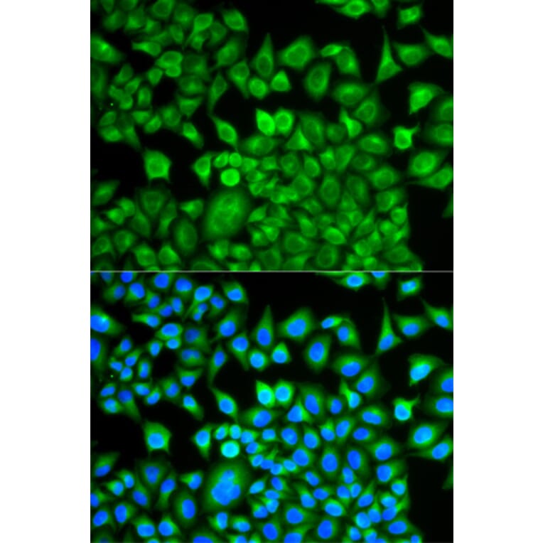 Anti-FABP1 Antibody from Bioworld Technology (BS7533) - Antibodies.com
