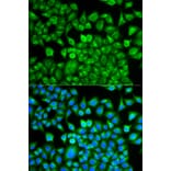 Anti-FABP1 Antibody from Bioworld Technology (BS7533) - Antibodies.com
