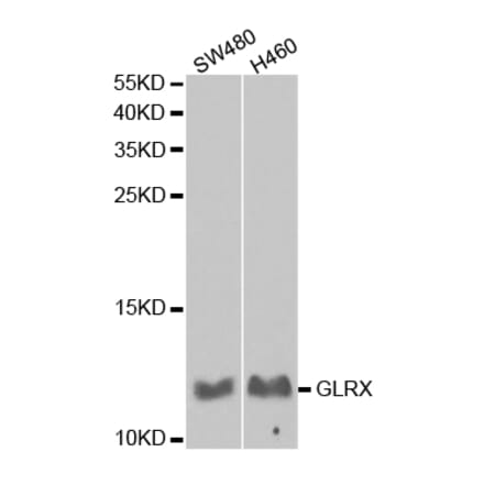 Anti-GLRX Antibody from Bioworld Technology (BS7534) - Antibodies.com