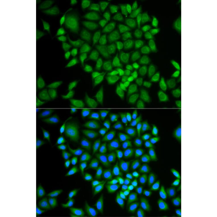 Anti-GLRX Antibody from Bioworld Technology (BS7534) - Antibodies.com