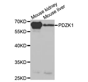 Anti-PDZK1 Antibody from Bioworld Technology (BS7538) - Antibodies.com