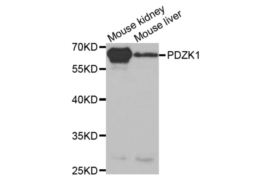 Anti-PDZK1 Antibody from Bioworld Technology (BS7538) - Antibodies.com