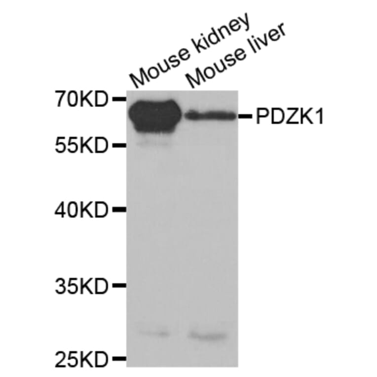 Anti-PDZK1 Antibody from Bioworld Technology (BS7538) - Antibodies.com
