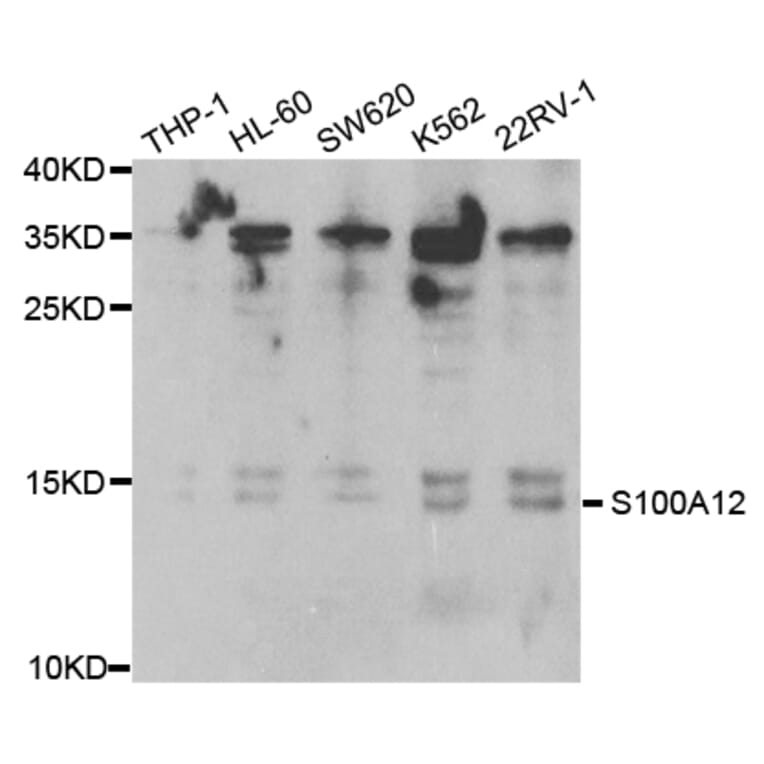 Anti-S100A12 Antibody from Bioworld Technology (BS7539) - Antibodies.com