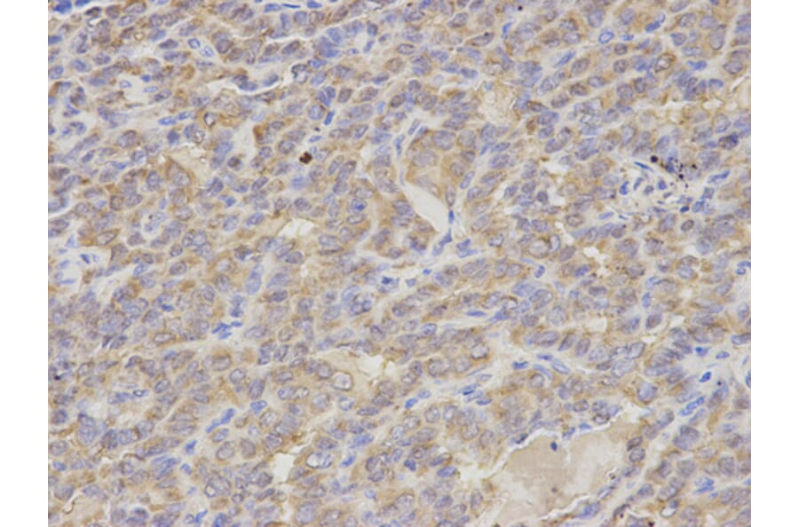 Anti-S100A12 Antibody from Bioworld Technology (BS7539) - Antibodies.com