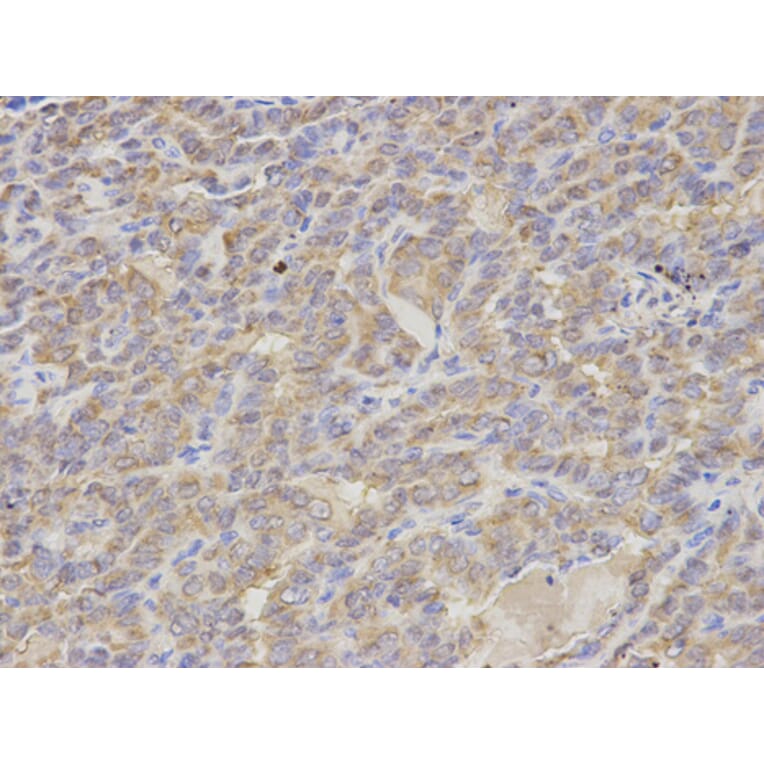 Anti-S100A12 Antibody from Bioworld Technology (BS7539) - Antibodies.com