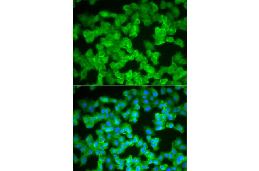 Anti-S100A12 Antibody from Bioworld Technology (BS7539) - Antibodies.com