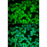 Anti-S100A12 Antibody from Bioworld Technology (BS7539) - Antibodies.com