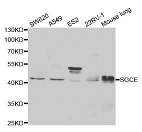 Anti-SGCE Antibody from Bioworld Technology (BS7541) - Antibodies.com