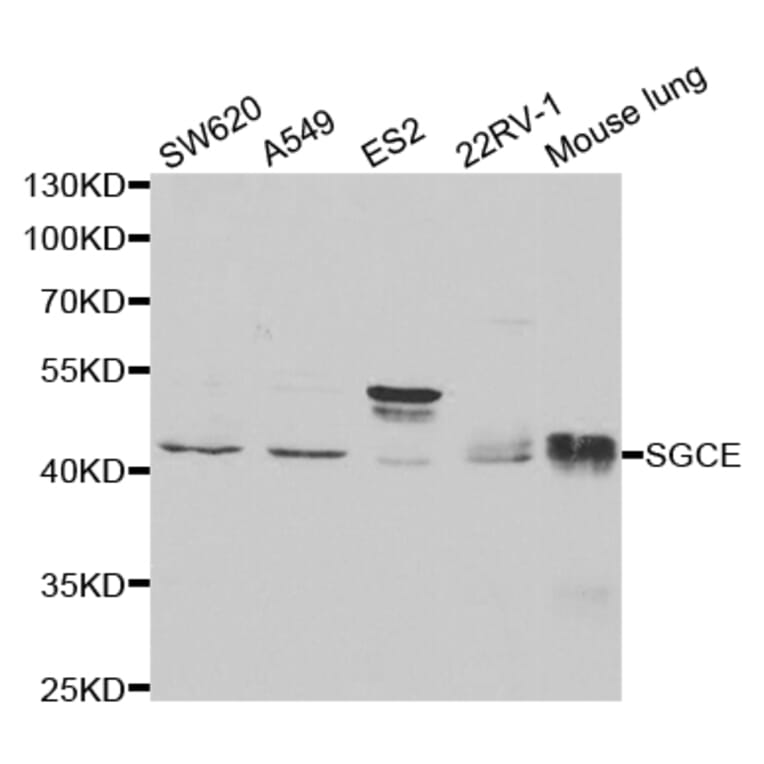 Anti-SGCE Antibody from Bioworld Technology (BS7541) - Antibodies.com