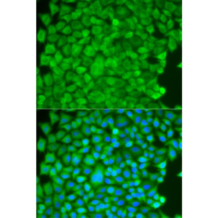 Anti-SGCE Antibody from Bioworld Technology (BS7541) - Antibodies.com