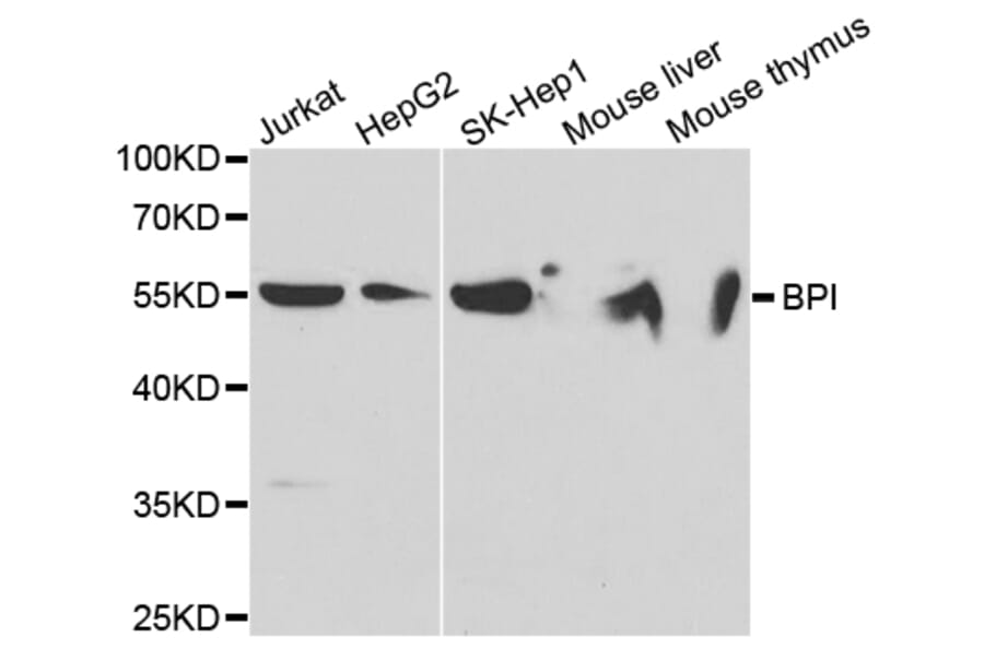 Anti-BPI Antibody from Bioworld Technology (BS7543) - Antibodies.com