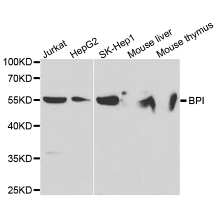 Anti-BPI Antibody from Bioworld Technology (BS7543) - Antibodies.com