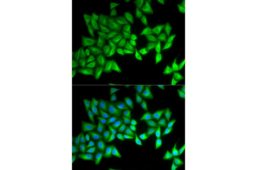 Anti-BPI Antibody from Bioworld Technology (BS7543) - Antibodies.com