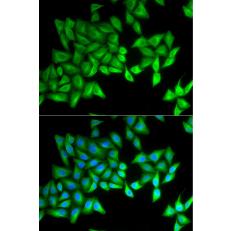 Anti-BPI Antibody from Bioworld Technology (BS7543) - Antibodies.com