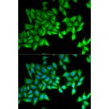 Anti-BPI Antibody from Bioworld Technology (BS7543) - Antibodies.com