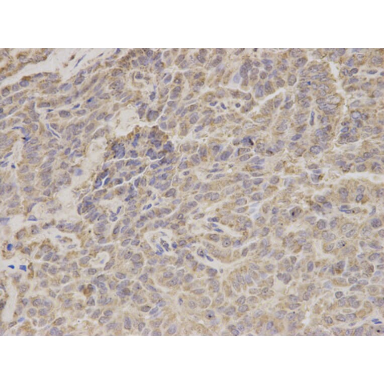Anti-HADHA Antibody from Bioworld Technology (BS7546) - Antibodies.com