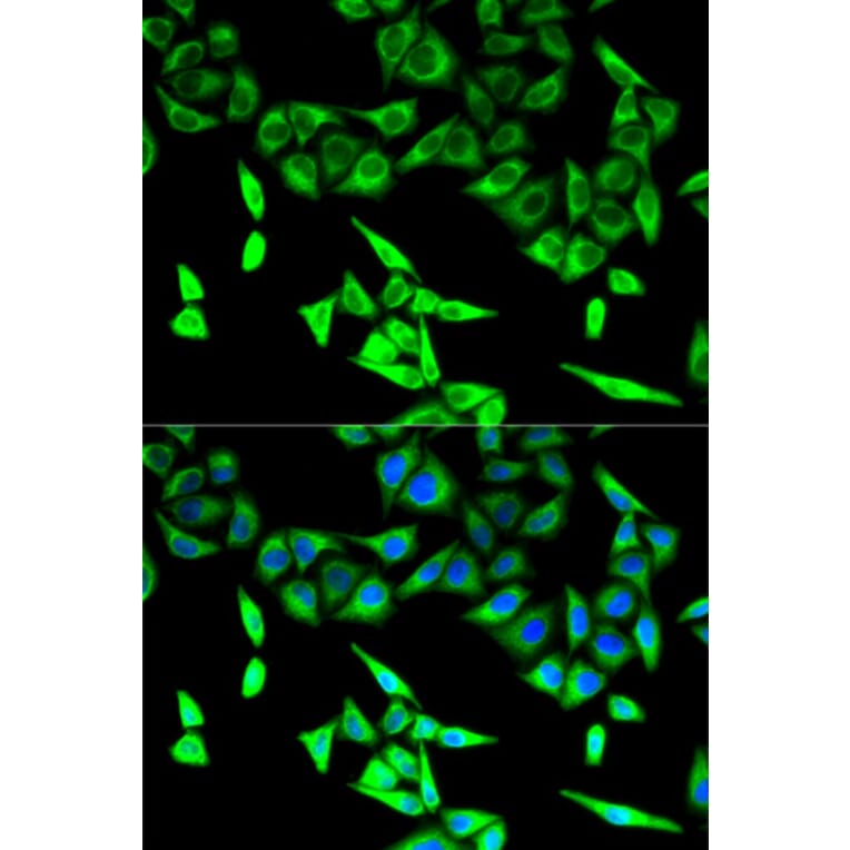 Anti-HADHA Antibody from Bioworld Technology (BS7546) - Antibodies.com