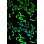 Anti-HADHA Antibody from Bioworld Technology (BS7546) - Antibodies.com