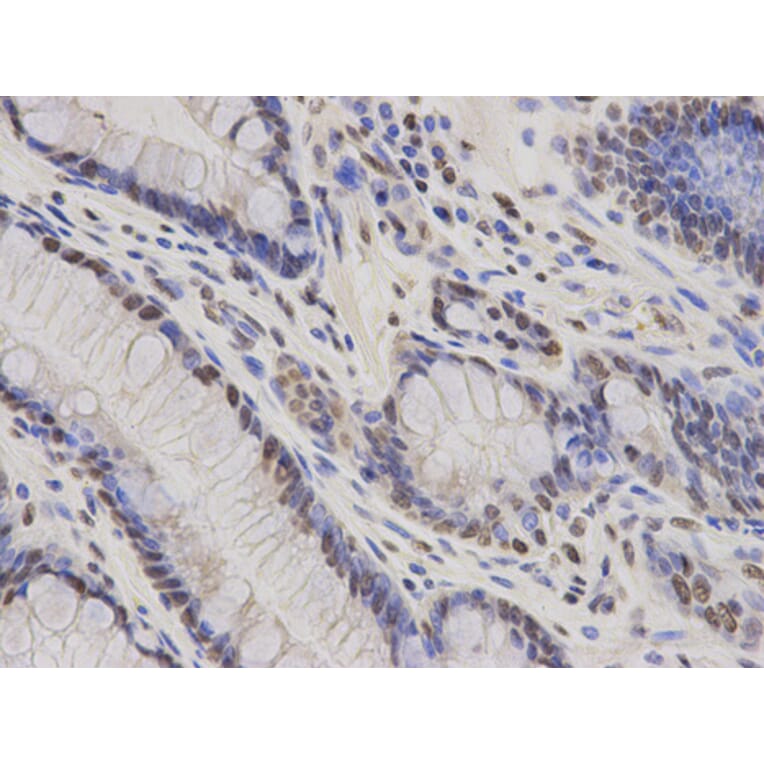 Anti-HDGF Antibody from Bioworld Technology (BS7547) - Antibodies.com