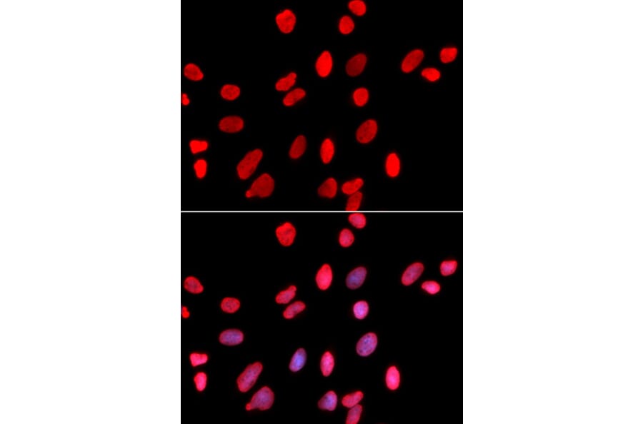 Anti-HDGF Antibody from Bioworld Technology (BS7547) - Antibodies.com