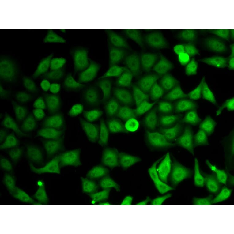 Anti-IMPDH2 Antibody from Bioworld Technology (BS7549) - Antibodies.com