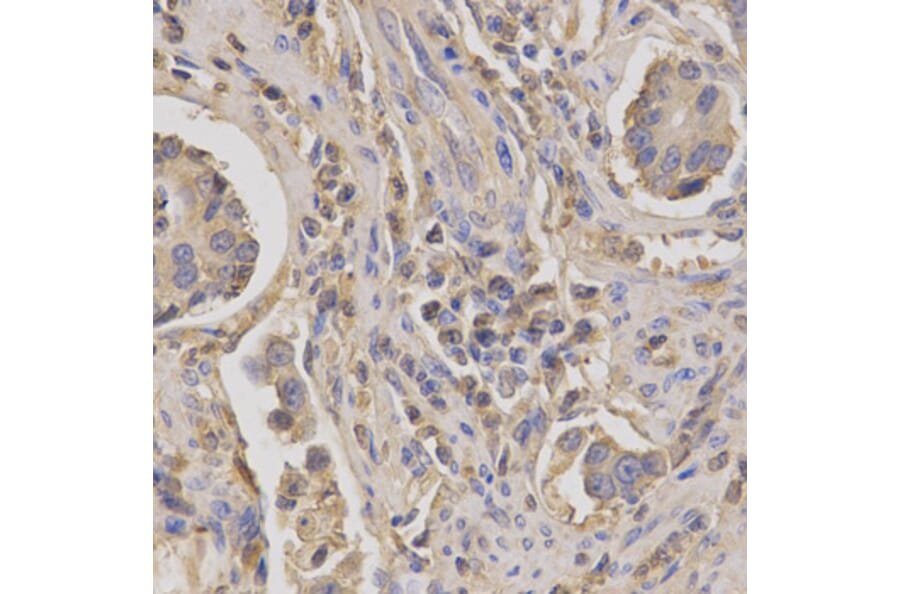 Anti-LUM Antibody from Bioworld Technology (BS7550) - Antibodies.com