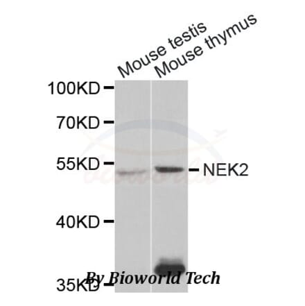 Anti-NEK2 Antibody from Bioworld Technology (BS7552) - Antibodies.com