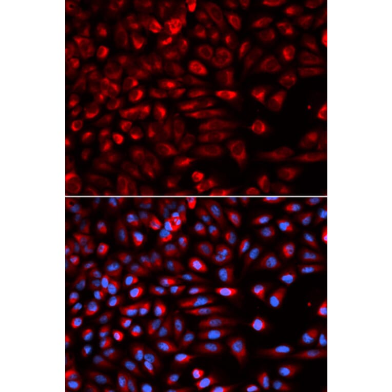 Anti-NEK2 Antibody from Bioworld Technology (BS7552) - Antibodies.com