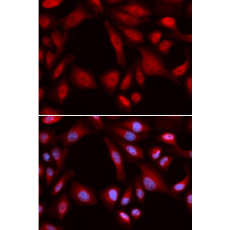 Anti-PSMD7 Antibody from Bioworld Technology (BS7553) - Antibodies.com