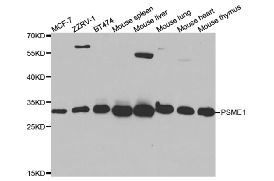 Anti-PSME1 Antibody from Bioworld Technology (BS7554) - Antibodies.com