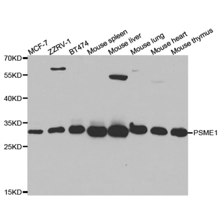 Anti-PSME1 Antibody from Bioworld Technology (BS7554) - Antibodies.com
