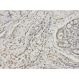 Anti-PSME1 Antibody from Bioworld Technology (BS7554) - Antibodies.com