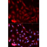 Anti-PSME1 Antibody from Bioworld Technology (BS7554) - Antibodies.com