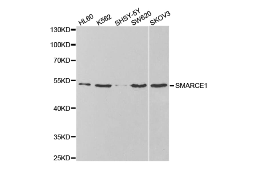 Anti-SMARCE1 Antibody from Bioworld Technology (BS7555) - Antibodies.com
