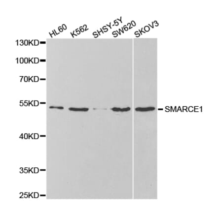 Anti-SMARCE1 Antibody from Bioworld Technology (BS7555) - Antibodies.com