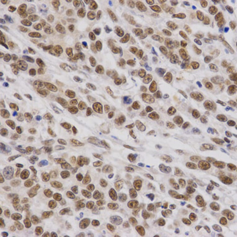 Anti-SMARCE1 Antibody from Bioworld Technology (BS7555) - Antibodies.com