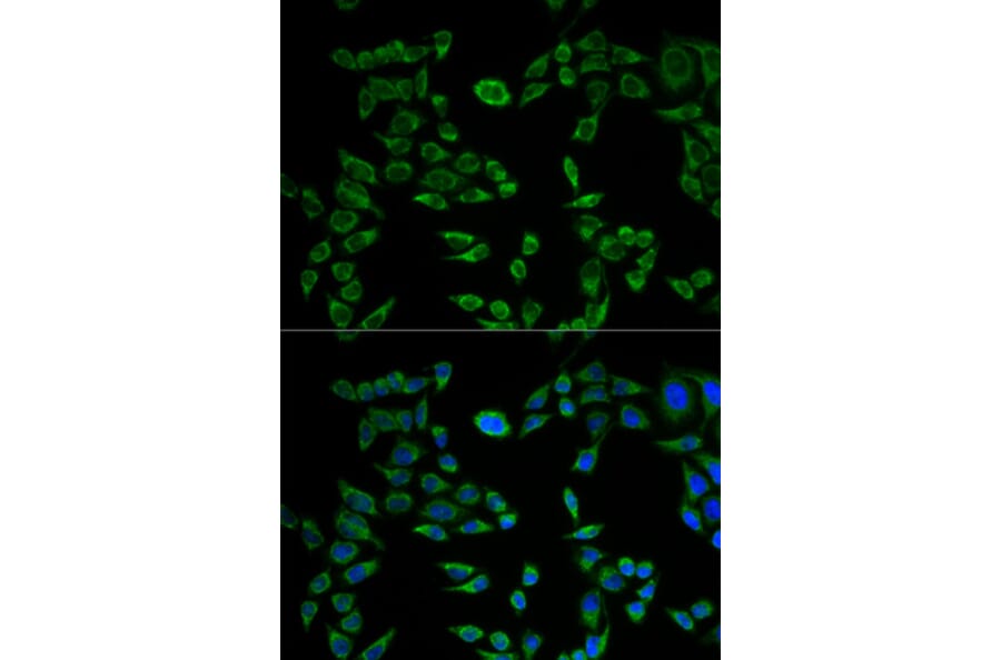 Anti-VAPB Antibody from Bioworld Technology (BS7557) - Antibodies.com