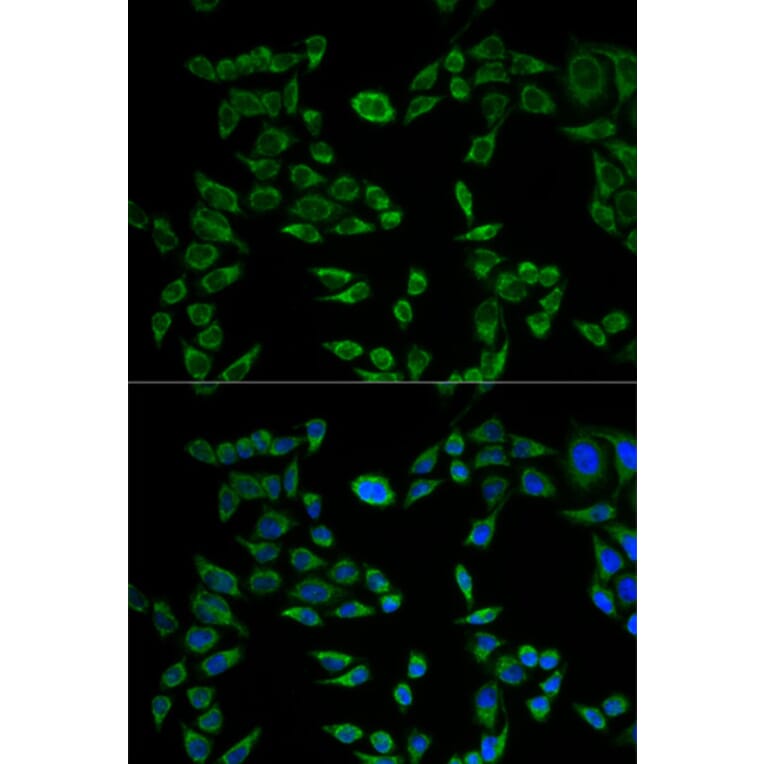 Anti-VAPB Antibody from Bioworld Technology (BS7557) - Antibodies.com